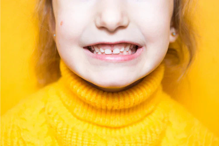 A child smiling to show her buck teeth