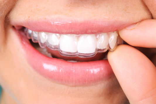 A girl is wearing retainers for teeth