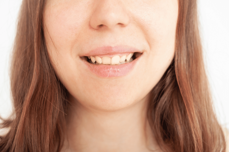 Prevention of Dental Plaque Buildup