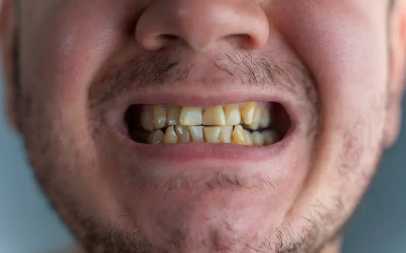 Does Vaping Stain Your Teeth? Learn About Teeth Whitening Solutions! Does Vaping Stain Your Teeth? Learn About Teeth Whitening Solutions!
