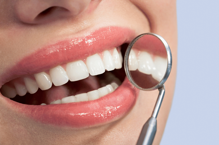 At-Home Teeth Straightening