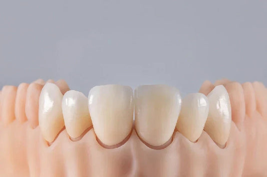 Visual representation of anterior teeth positioning