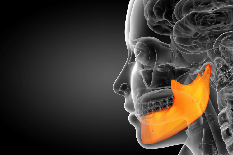 TMJ Disorder with Clear Aligners