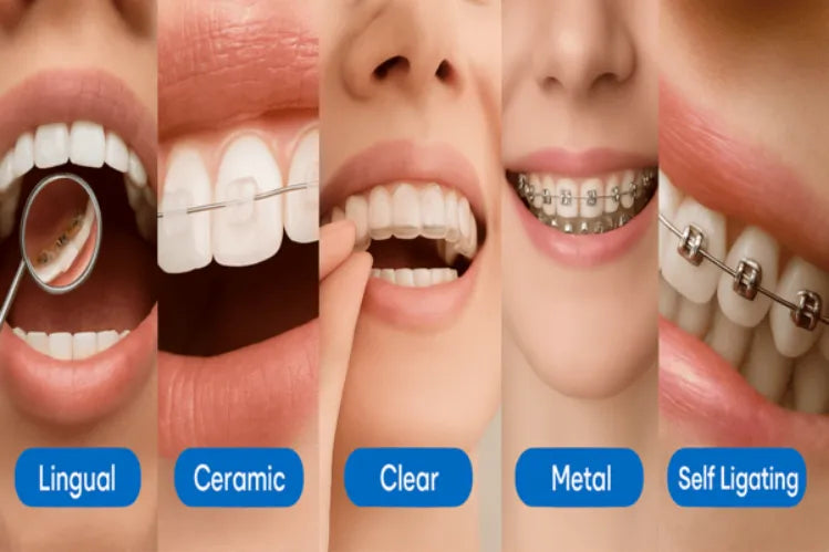  Different types of teeth straightening treatments 