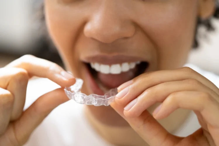 The Ultimate Guide to Life with Clear Aligners: What You Need to Know
