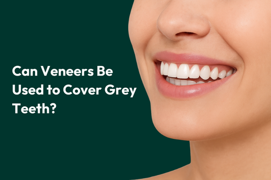 A girl smiling widely while having veneers 