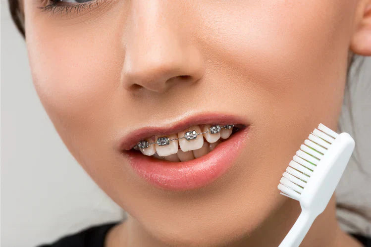 A close-up of a woman showing a gap between her anterior front teeth 