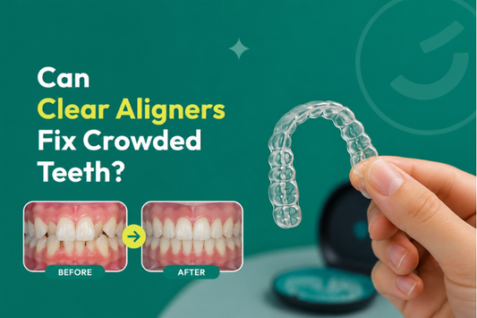 A hand holding a clear aligner beside before-and-after images of crowded teeth alignment.