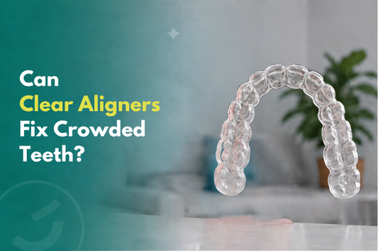 A close-up of a clear aligner.