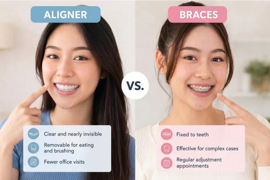 Two girls in comparison: one is wearing a clear aligner, and the other has braces on her teeth.