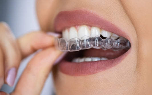 A close-up of a girl applying clear retainers