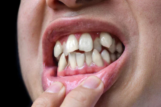 An image of a man with crooked teeth.