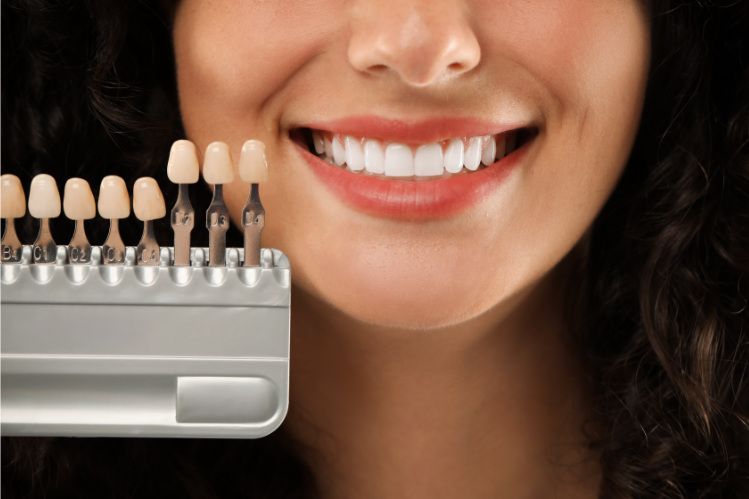 A woman smiling next to a set of dental veneers