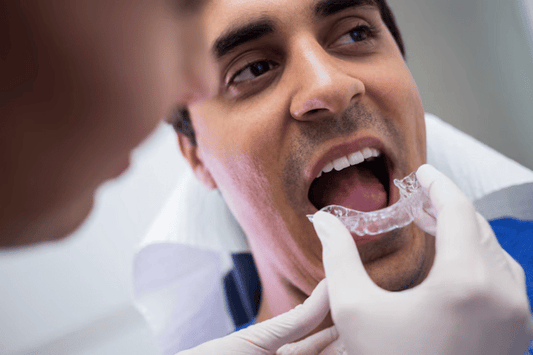 Clear aligners.