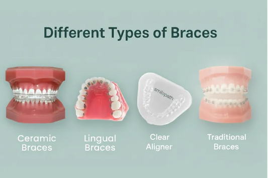 Different types of braces in New Zealand