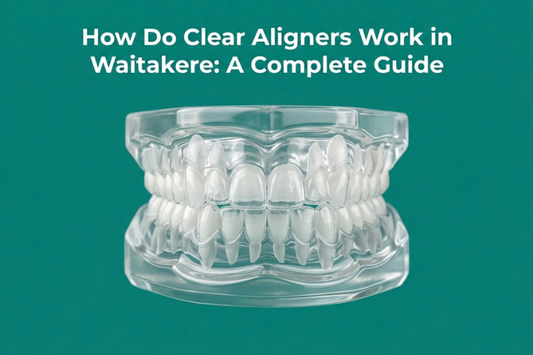 How Do Clear Aligners Work in Waitakere City?