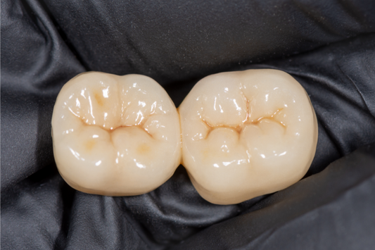 An image of two ceramic molar crowns.