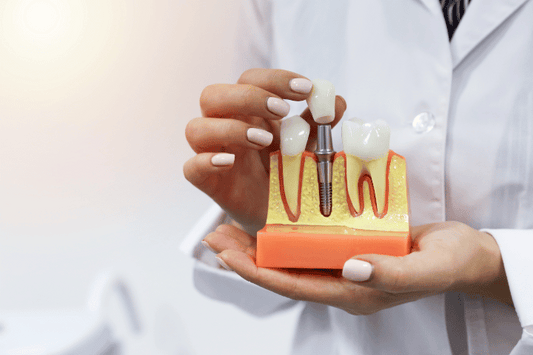 Fix overjet with clear aligners