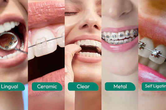  An illustration shows various types of braces
