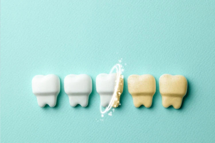 Unlock Your Brightest Smile: Proven Techniques for Maximizing Your Teeth-Whitening Kit