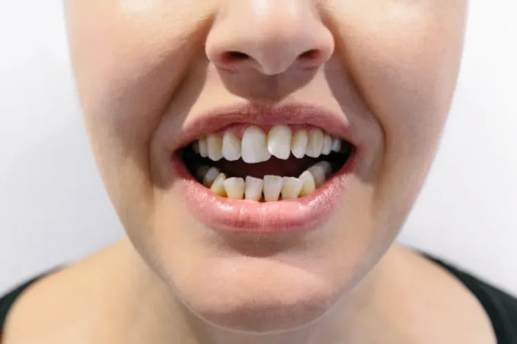 A girl with wonky or crooked teeth