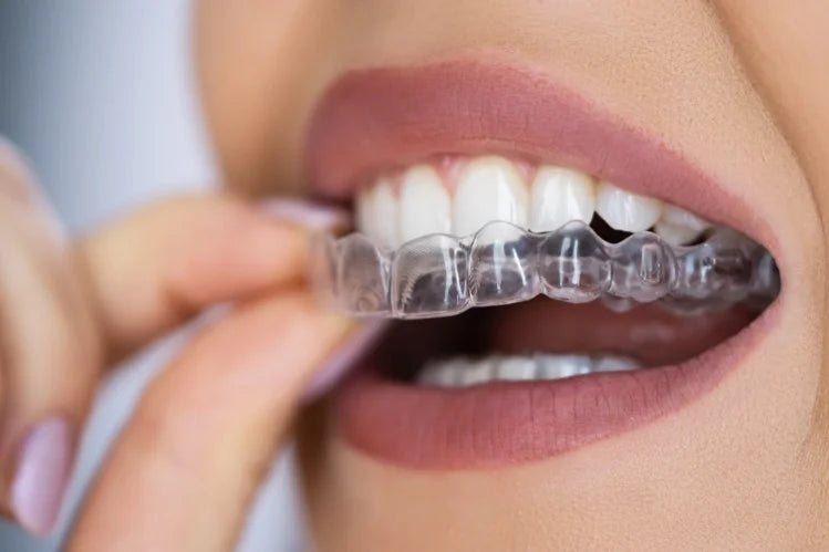 Invisible_Aligners