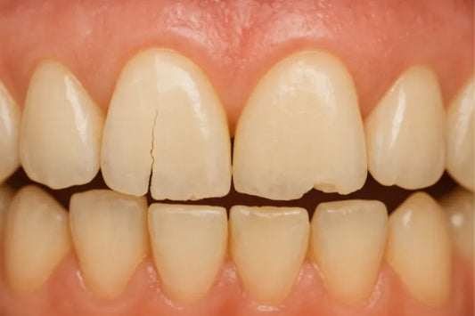 An image shows brittle teeth