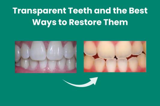 White teeth vs transparent teeth