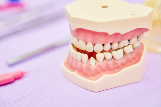 a teeth model with class 1 malocclusion
