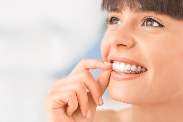 The Cost of Clear Aligners in NZ 2023: Understanding the Value of a Beautiful Smile