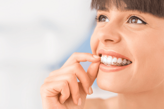The Cost of Clear Aligners in NZ 2023: Understanding the Value of a Beautiful Smile