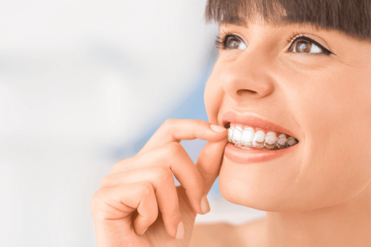The Cost of Clear Aligners in NZ 2026: Understanding the Value of a Beautiful Smile