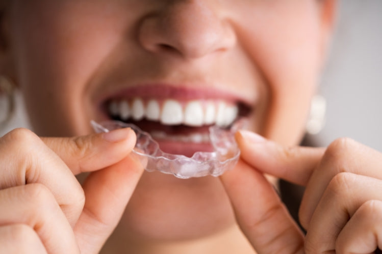 Clear Aligners: A Personalized Approach to Orthodontic Treatment