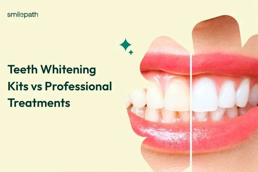 Teeth Whitening Kits vs Professional Treatments