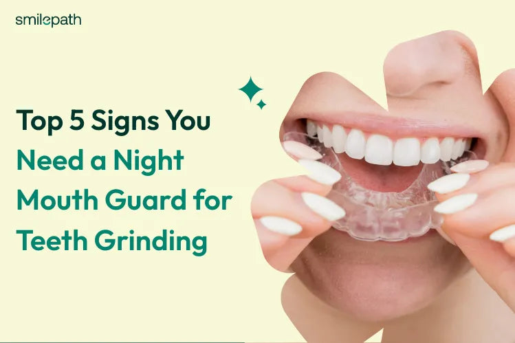 Top 5 Signs You Need a Night Mouth Guard for Teeth Grinding 