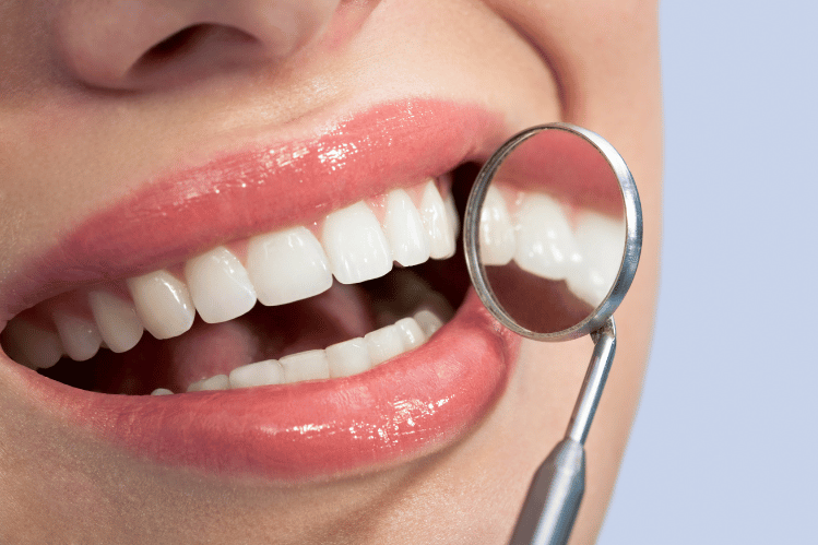  At-Home Teeth Straightening