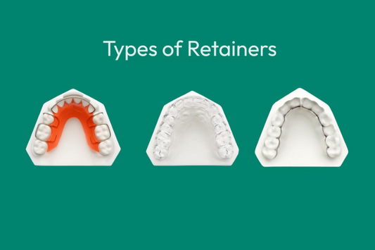An image showing the different types of retainers