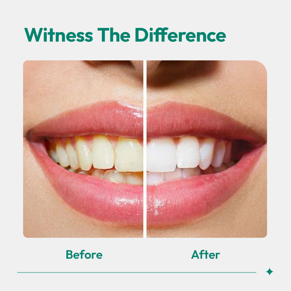 Aligner-Cleaner-Whitener-diifrence