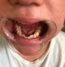 Before